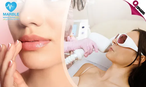 Fractional Laser  for Rosy Lips at Marble Plus Medical Center!